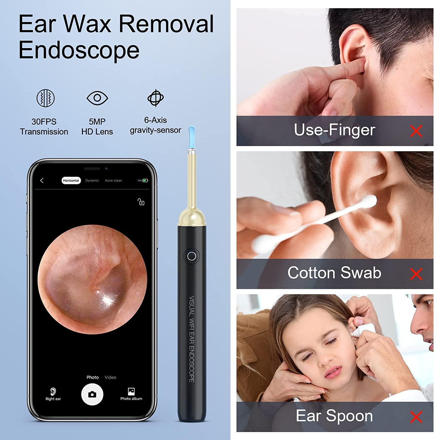 Ear Wax Removal Tool Camera, Wireless HD 1080P Ear Cleaner