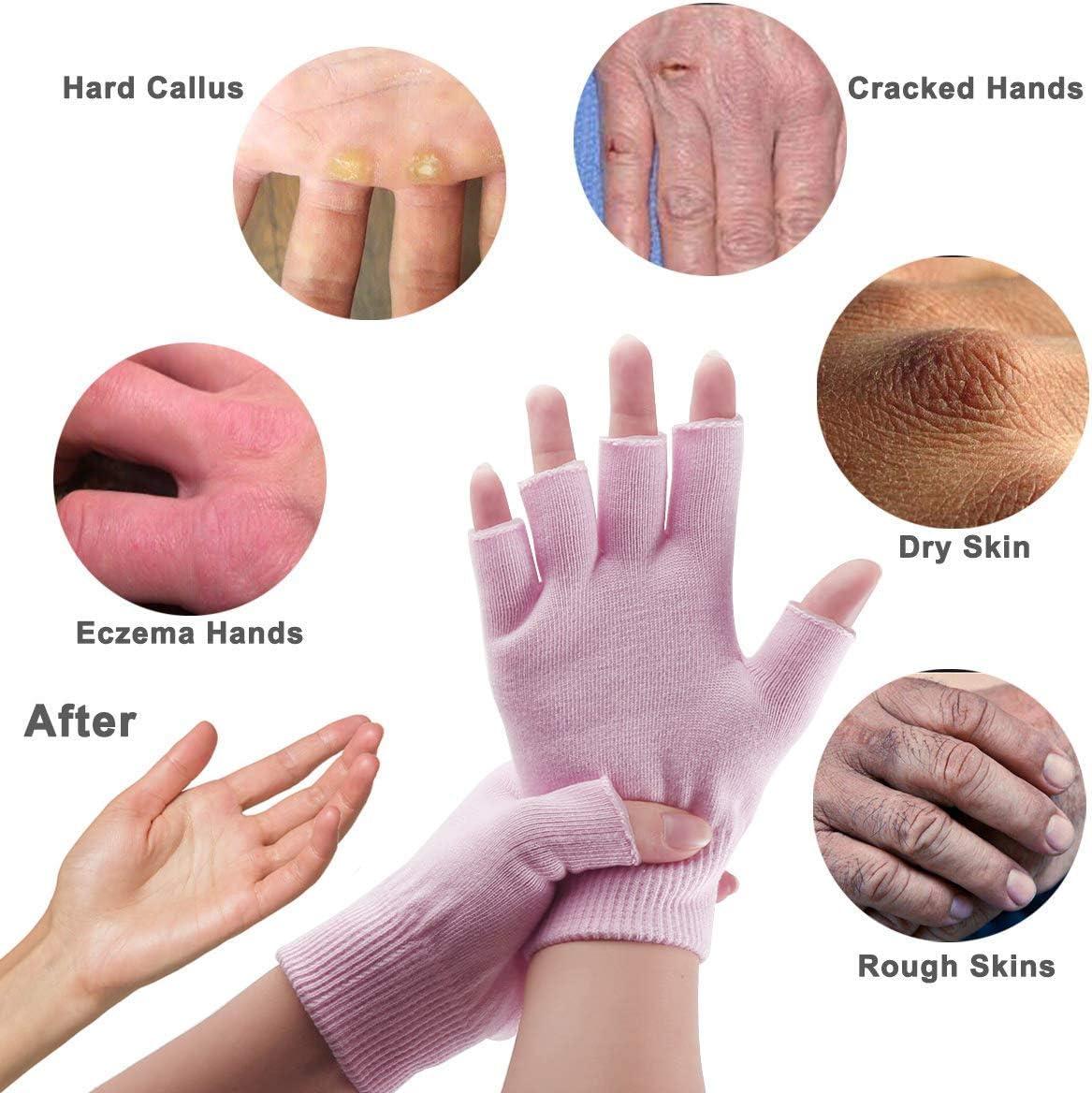 Fingerless Moisturizing Gloves for Dry Hand - Silicone Gel Infused Lotion  Spa Glove for Eczema Hand Skin Care Overnight Treatment
