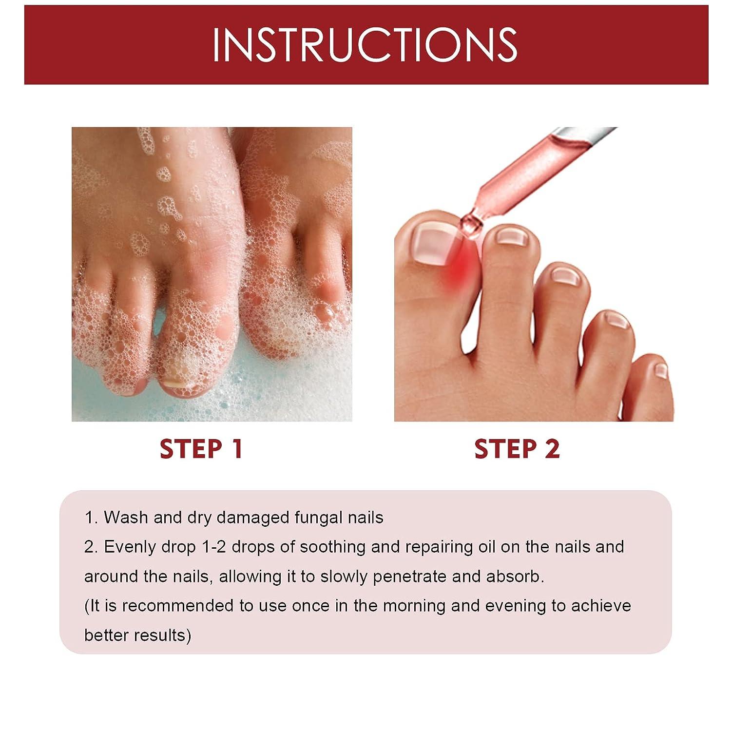 Most Common Toenail Problems | The Podiatry Group of South Texas