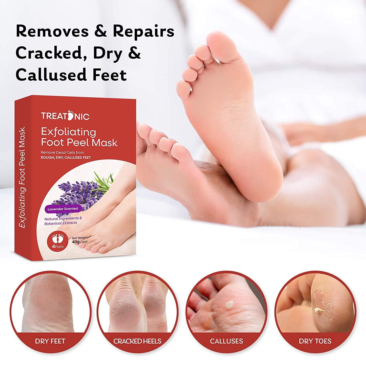 Foot Peel Mask,callus And Dead Skin Remover,nourish And Moisturize Dry  Rough Feet,soothe Cracked Feet And Heel - Temu