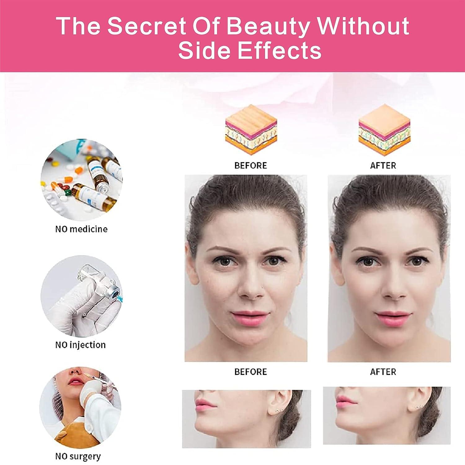 Generic Elastic Face Slimming Bandage V Line Face Shaper Women Chin Cheek  Lift Up Belt Facial Massage S