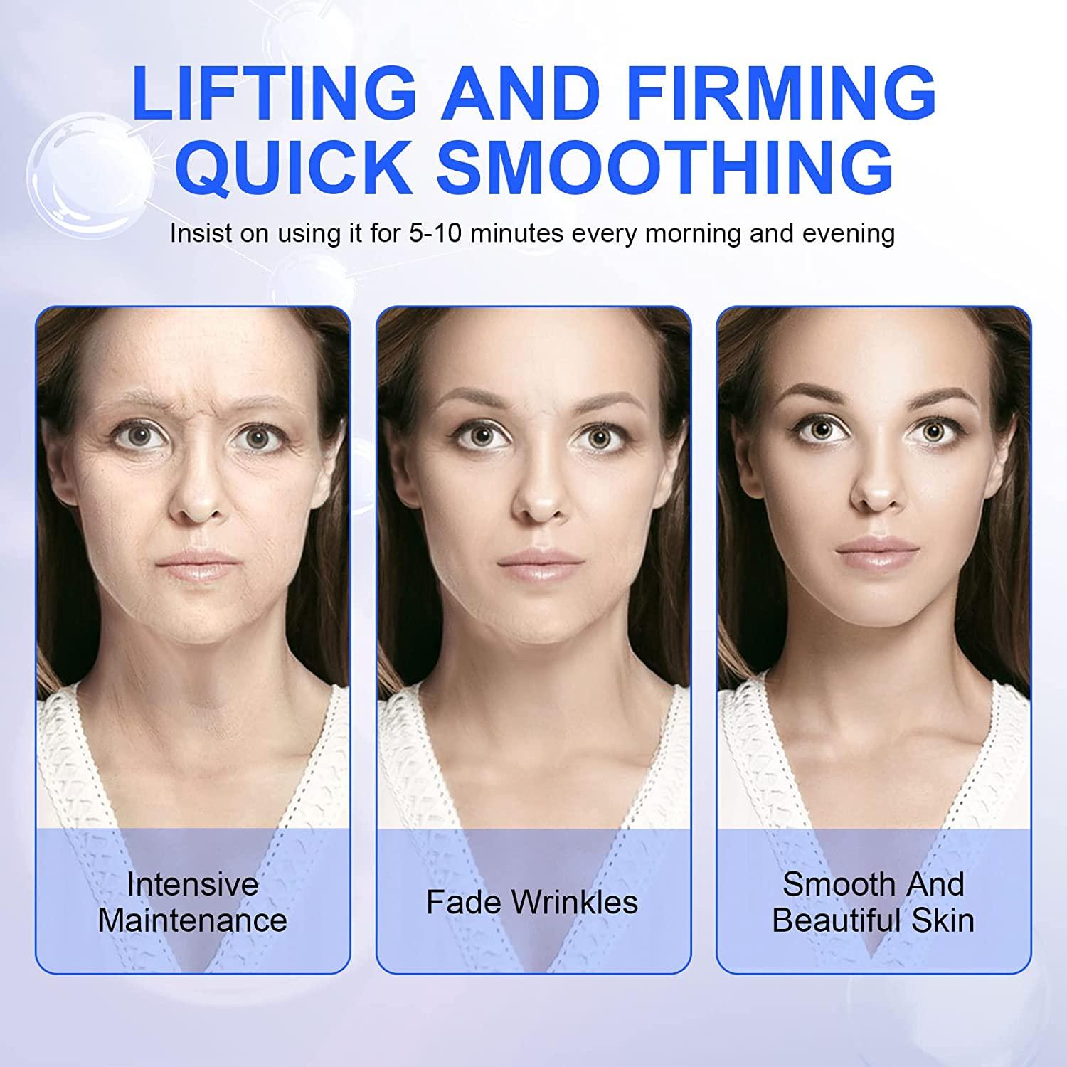 Lifting And Tightening Face-Lifting Device Facial Lifting And