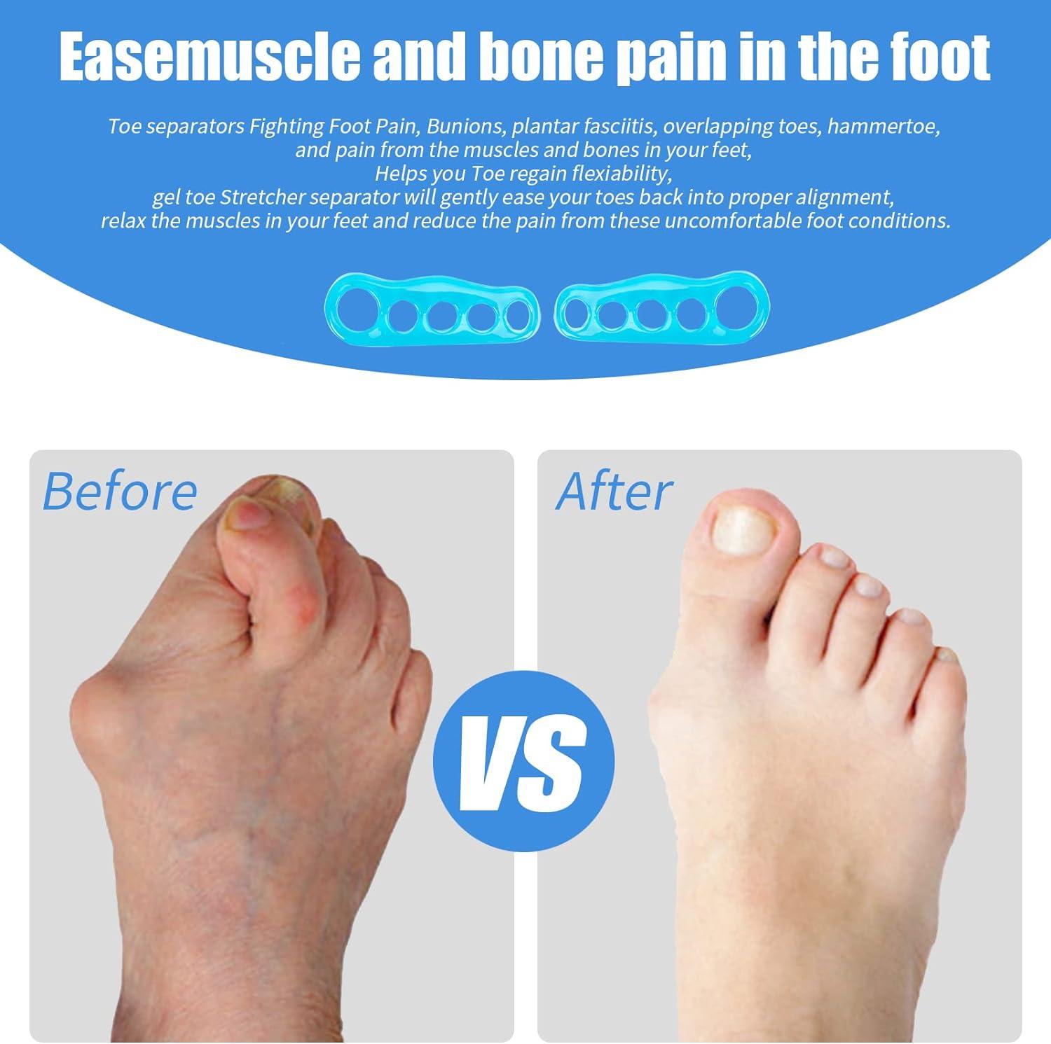 toe stretchers toe separator yoga muscle