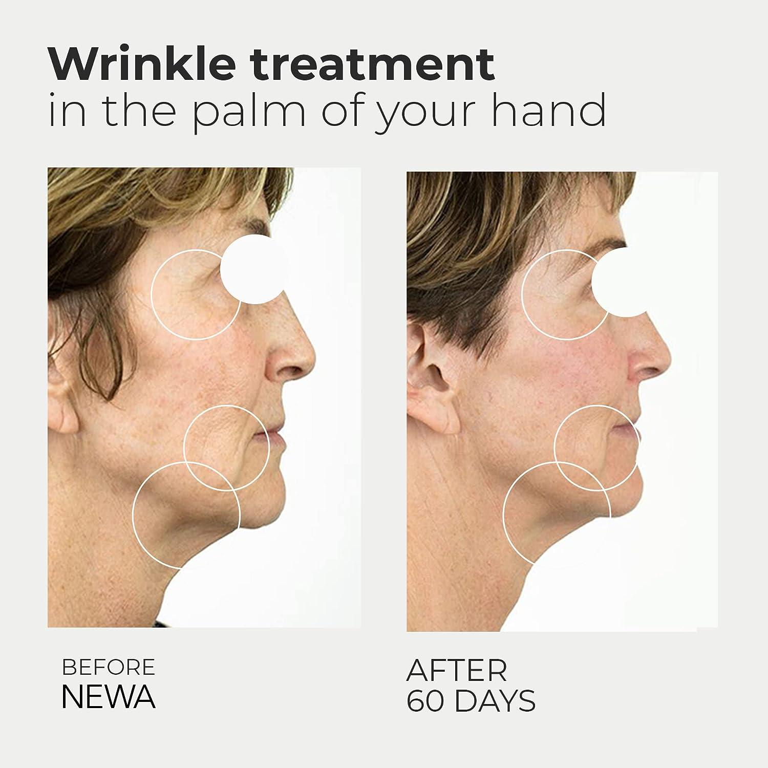 Using a TENS Unit for Wrinkles: What You Need to Know - Use or Not Use