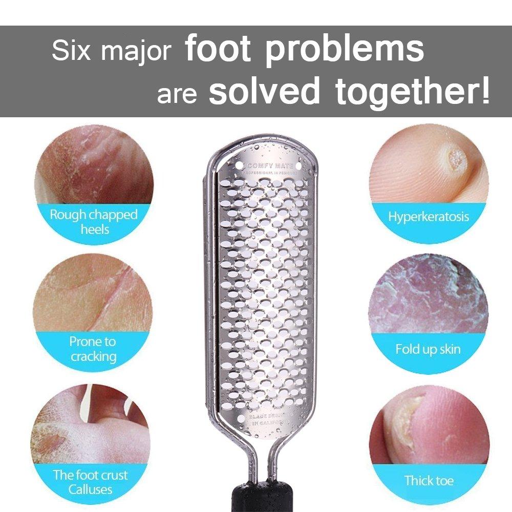 Foot File Hard Skin Remover Callus Shaver Corn Cutter Pedicure