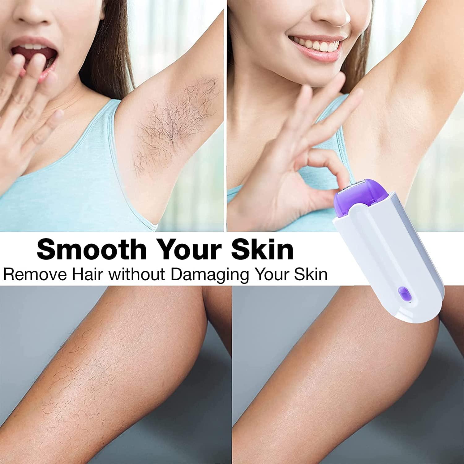 MySmoothSkin™ Dream Hair Eraser v2