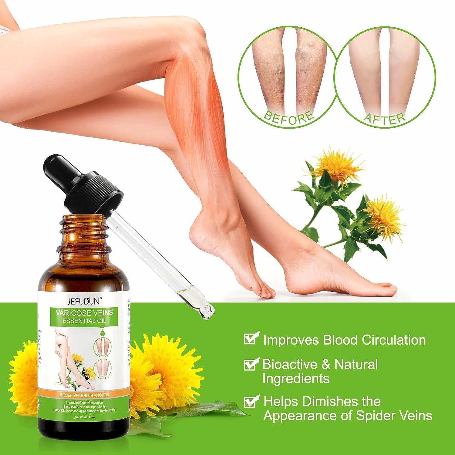 Circulation activating and draining oil for varicose veins