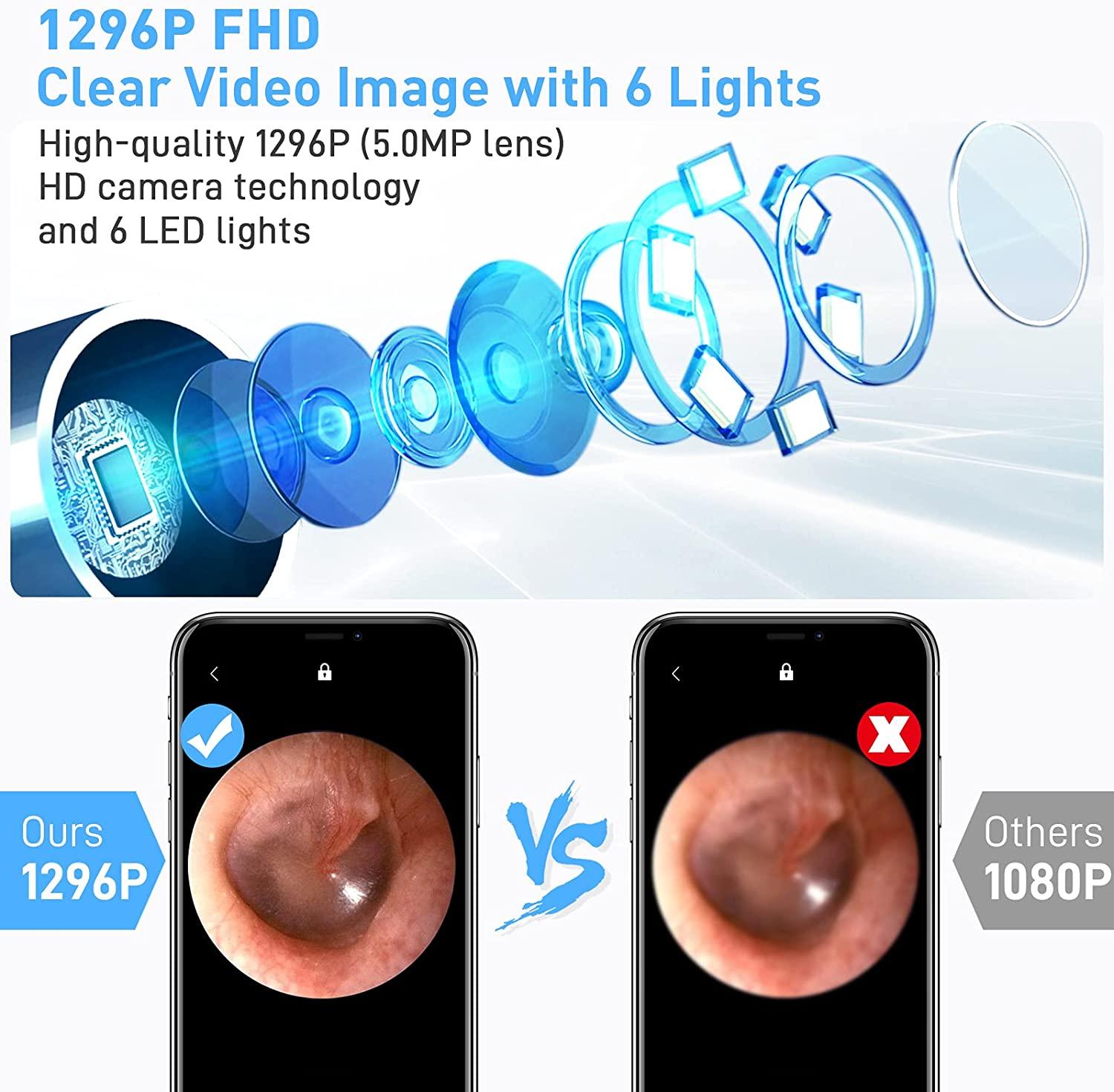 Caméra de retrait de cérumen AWELOR sans fil avec 6 lumières LED, étanchéité  IP67, nettoyeur d'oreille, caméra HD WiFi 1296P, outil de retrait du  cérumen pour iPhone et téléphones Android
