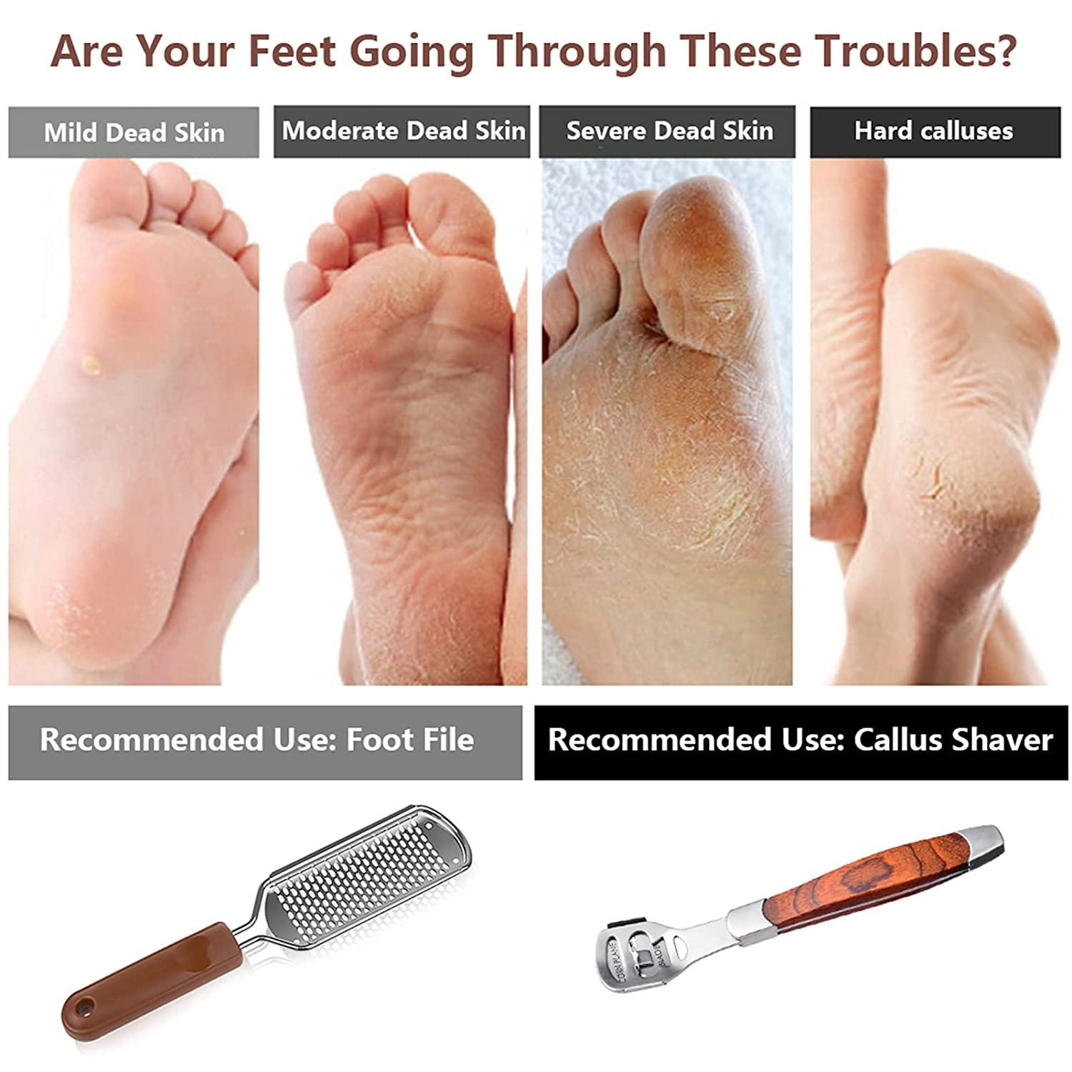 Pedicure Rasp Foot File Callus Remover Hard Dead Skin Heel Care Tool +  Blades