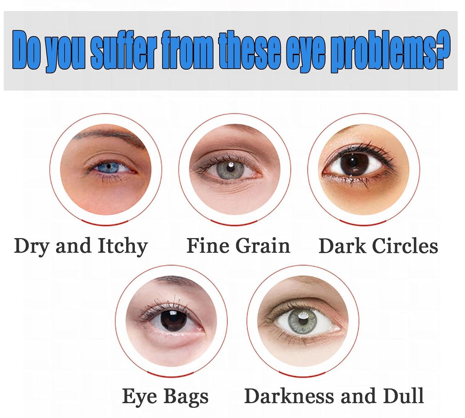 OPENEYES Awaken Peptide Lifting Eye GelMagic EffectHIMSE Awaken Peptide  Depuffing Eye Gel, Lifts Firming Anti-Wrinkle Eye Tightener - Reduces