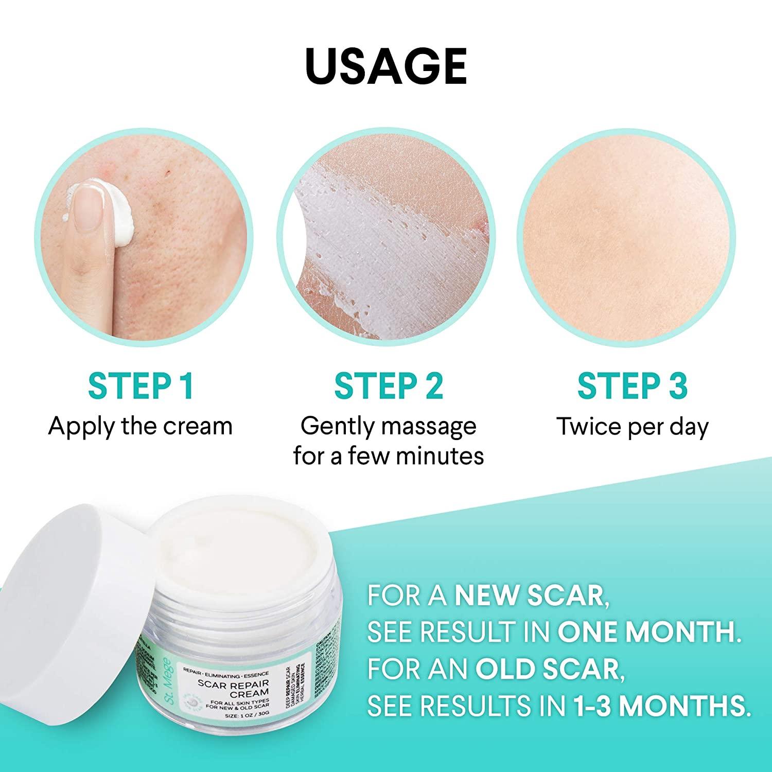 Scar Removal Serum for New and Old Scars Stretch Mark Removal