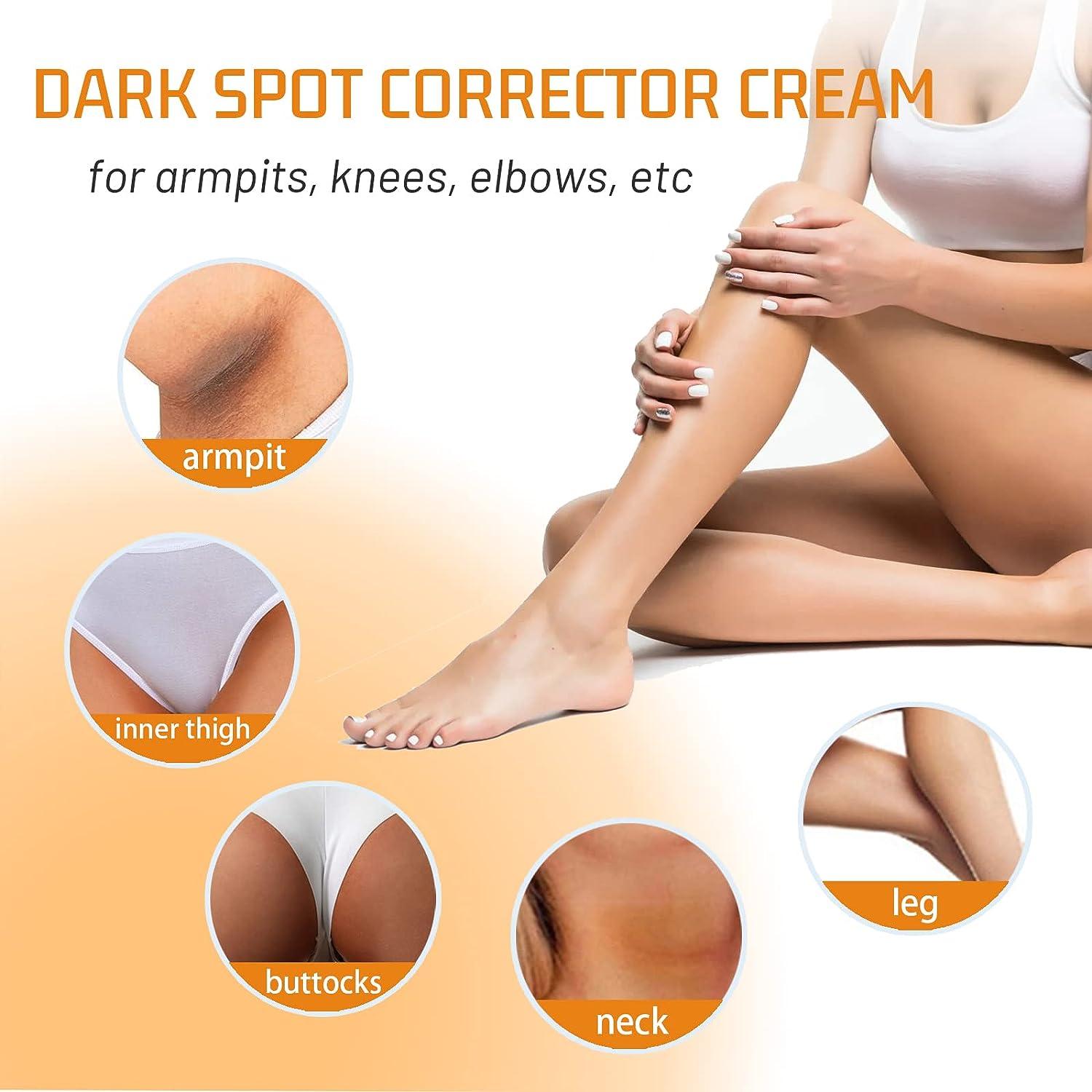  Dark Spot Remover Cream Instant Result: Dark Spot Corrector  for Body- Hyperpigmentation Cream for Underarm, Armpit, Elbows, Knees,  Neck, Inner Thigh, Back, Legs, Private Parts. 2 fl.oz//60ML : Beauty 