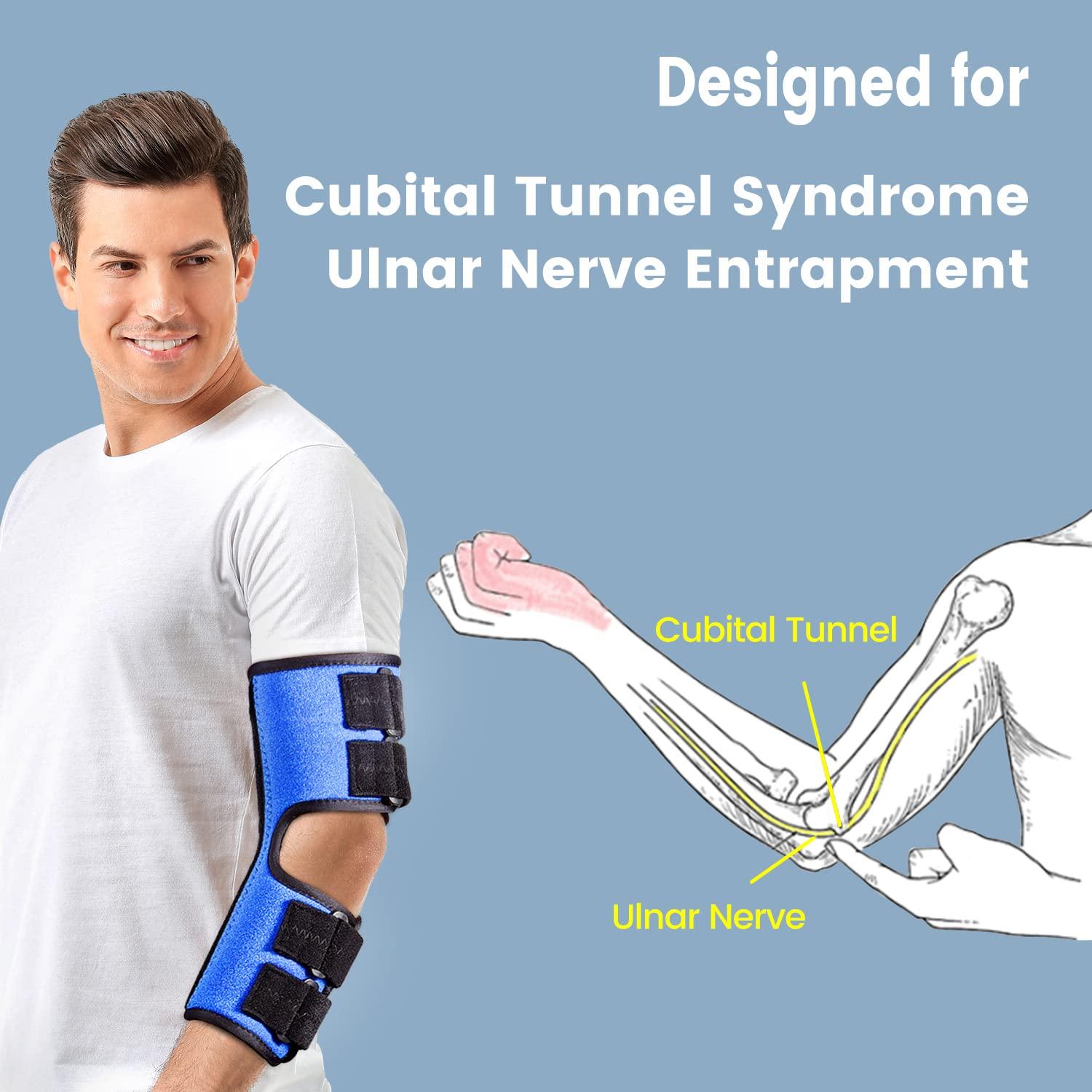 Elbow Splint Night and Day Brace for Ulnar Nerve Entrapment Cubital Tunnel  Syndrome for Left & Right Arm Immobilizer for Sleeping Extension and  Working Adjustable Angle Aluminum Bracket - S/M
