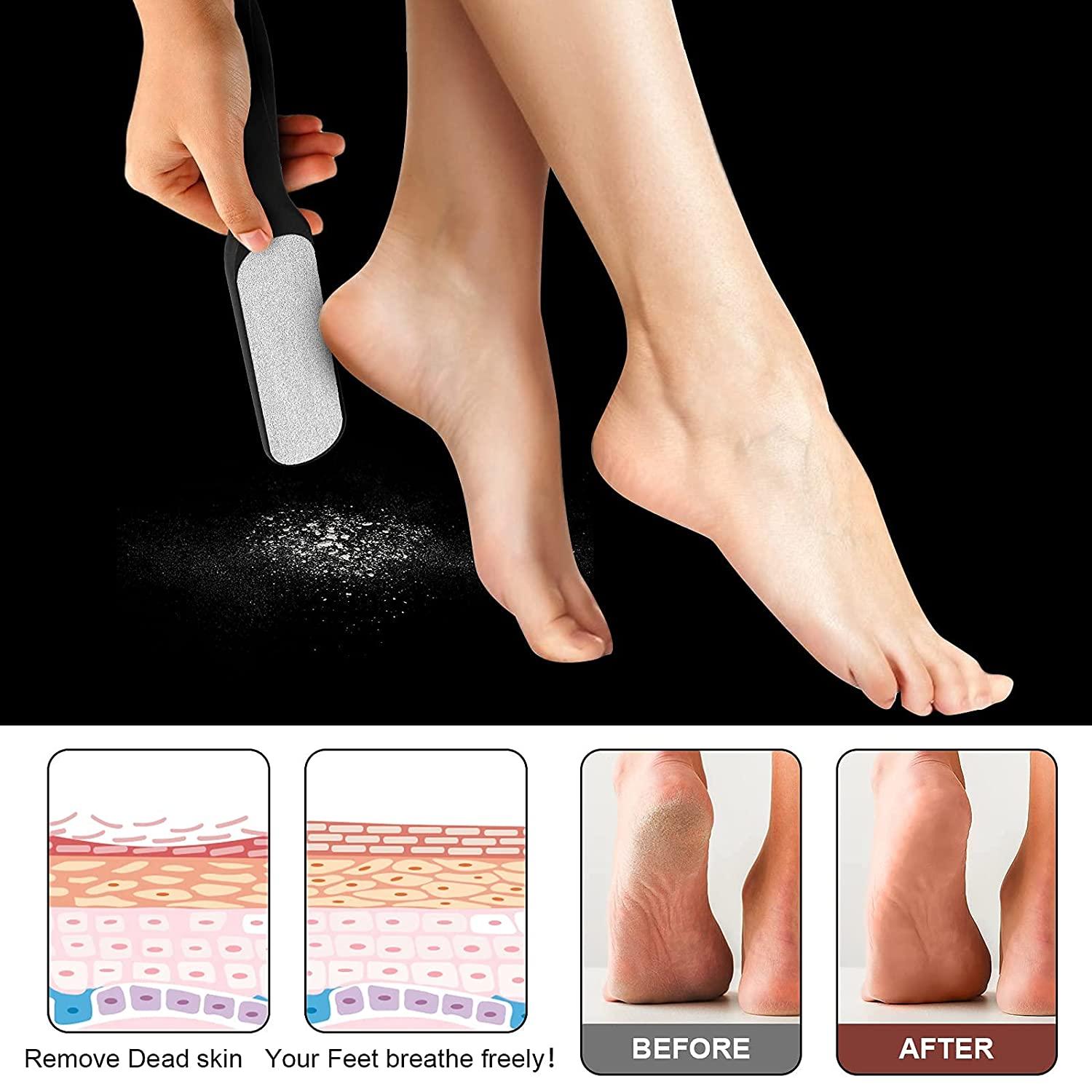 Manual Foot File Callus Remover Foot Scrubber Filer for Dead Skin, For  Parlour