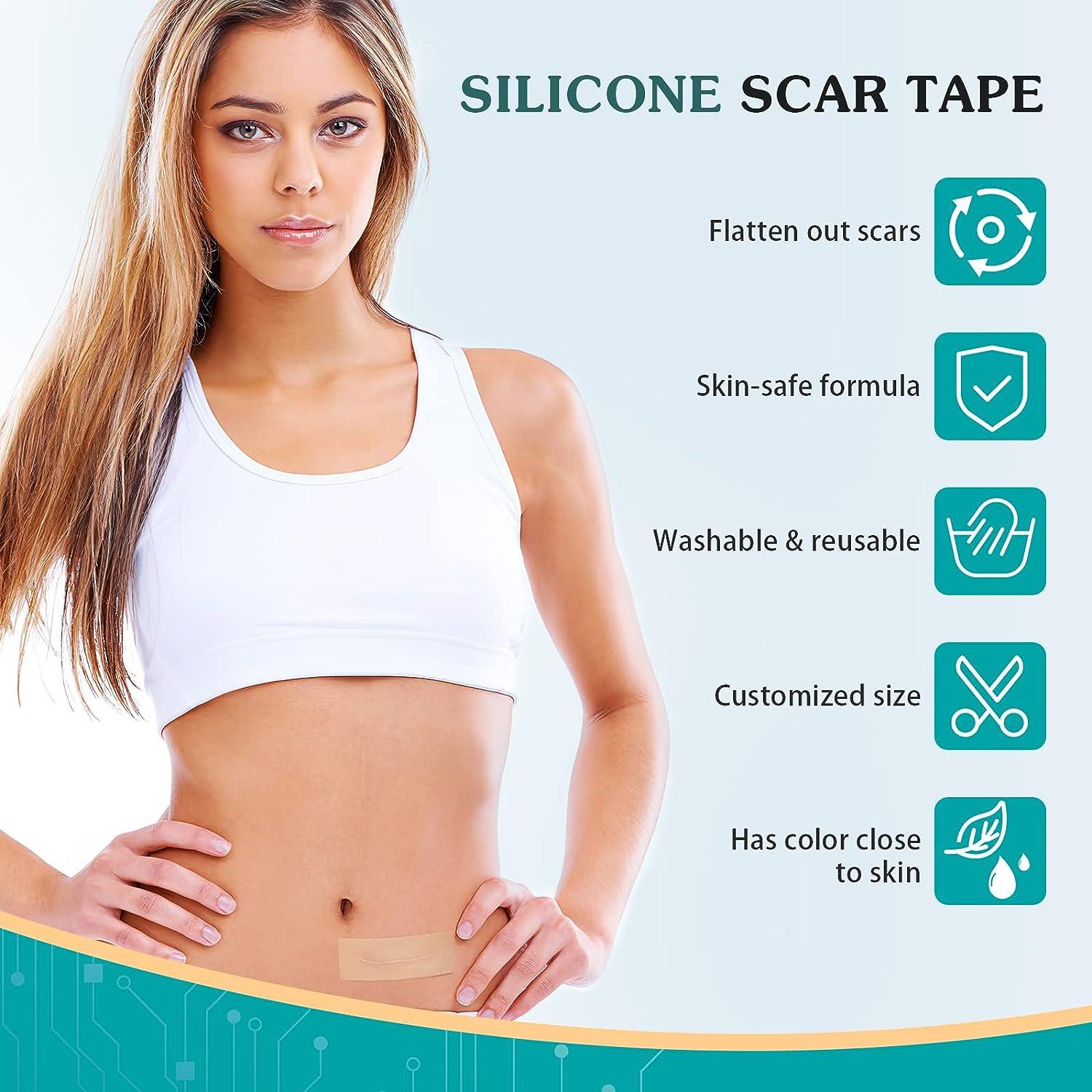 Silicone Scar Sheets (1.6 x 120Roll-3M), Silicone Scar Tape Roll, Scar Silicone  Strips, Reusable, Professional