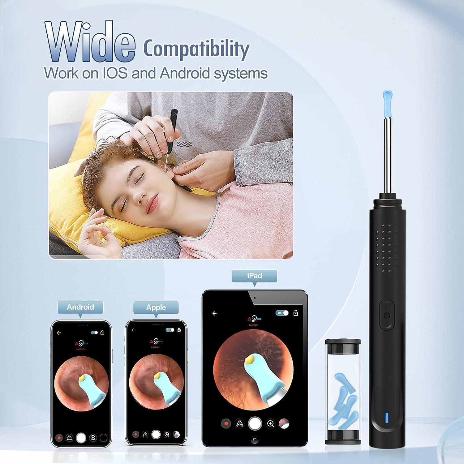 Ear Wax Removal Endoscope Bebird Wireless Visual Smart Ear Cleaner