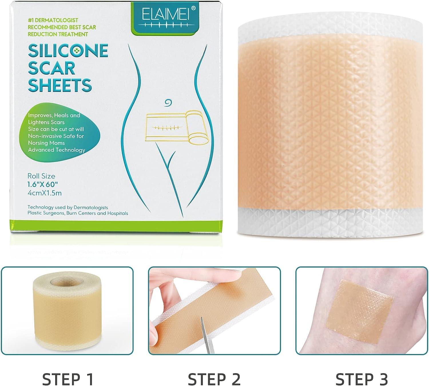 Silicone Scar Sheets(1.6'' X 60''roll-1.5m) - Soft Silicone Gel Scar Tape  Painless Silicone Tape Roll