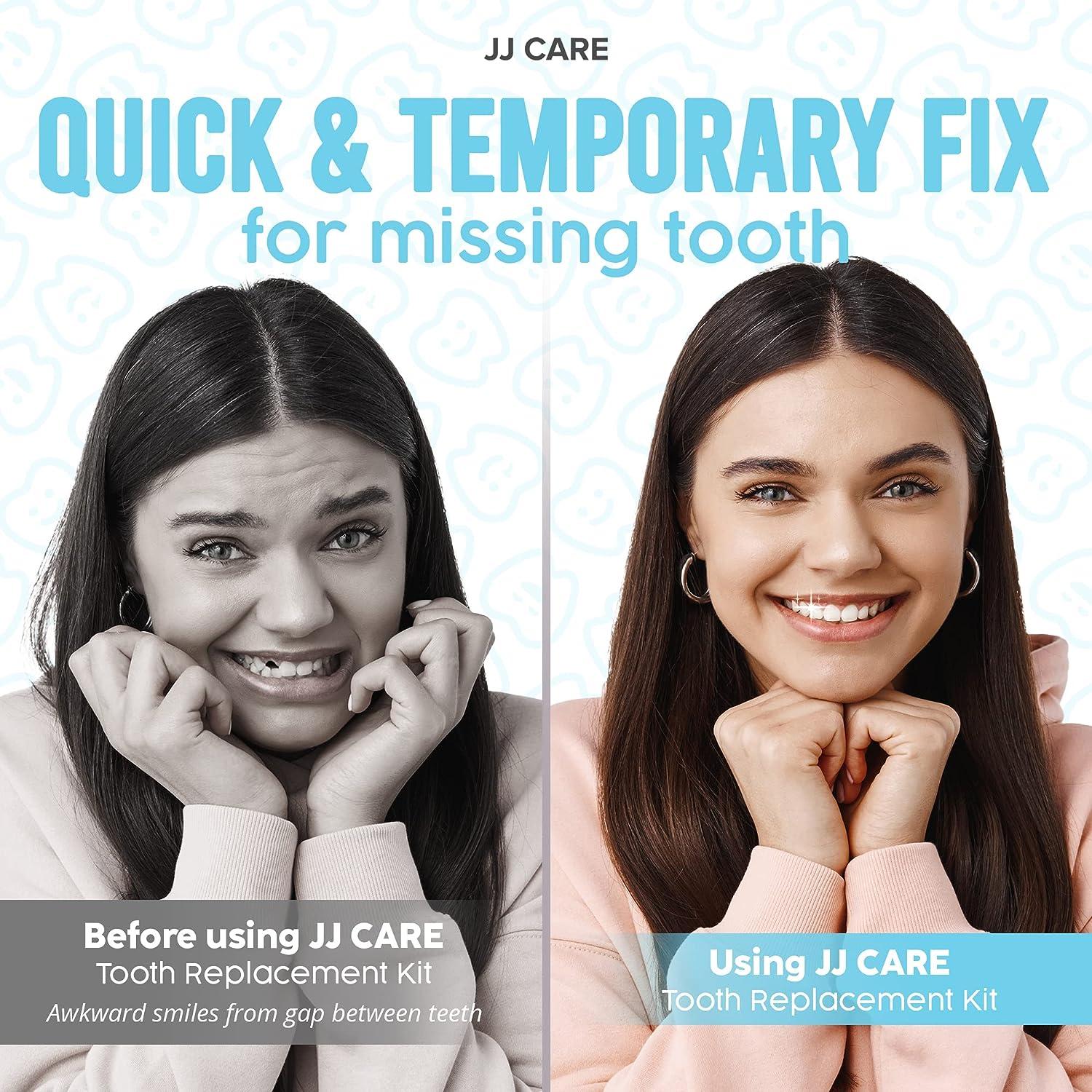 Temporary Teeth Repair Kit,Tooth Repair Kit For Missing Teeth, Cavity  Filler For Teeth,Temp Tooth Beads