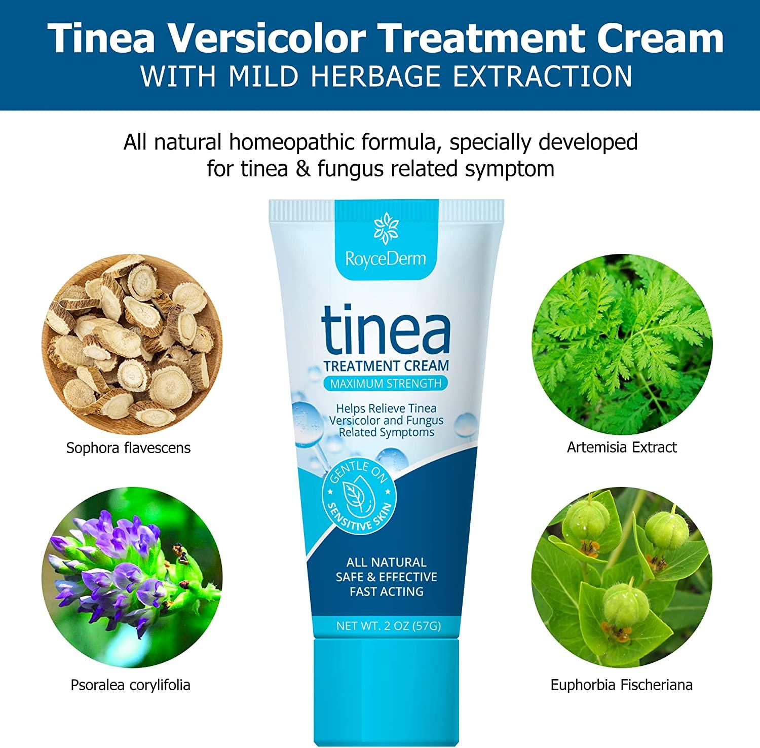 TINEA VERSICOLOR Pityriasis Versicolor Herbal Cream ANTIFUNGAL