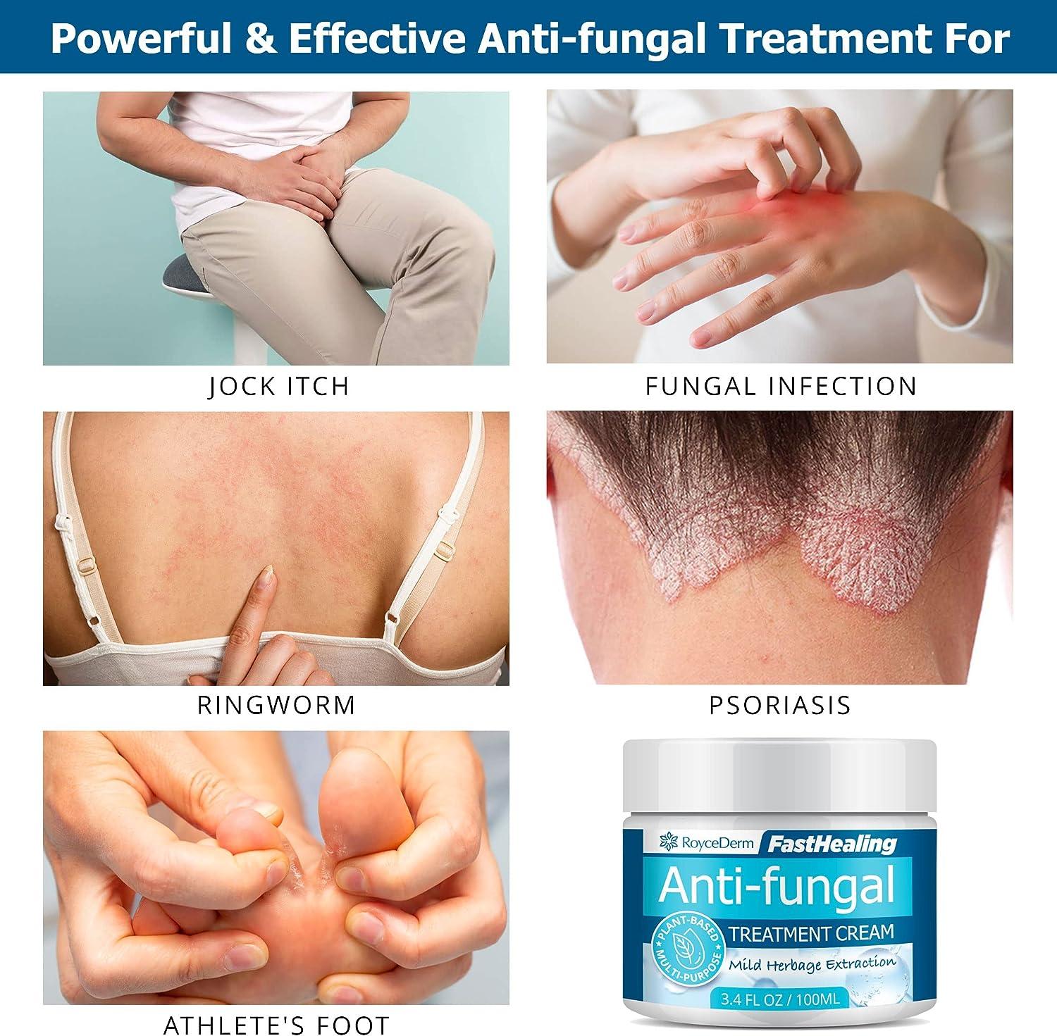 Best fungal skin infection cream, ring guard