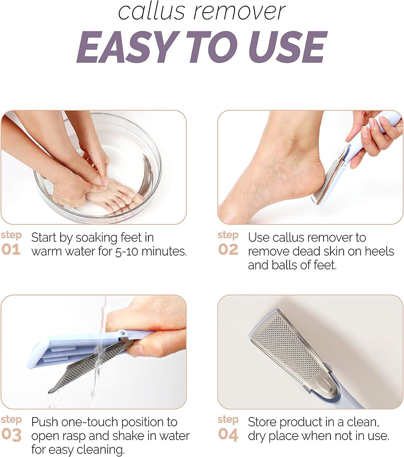 SHCKE Metal Foot Rasp Feet Callus Remover Foot Grater Professional Foot  Scrubber Pedicure Kit Foot Care Tool Stainless Steel Foot File Both Dry and  Wet Feet 