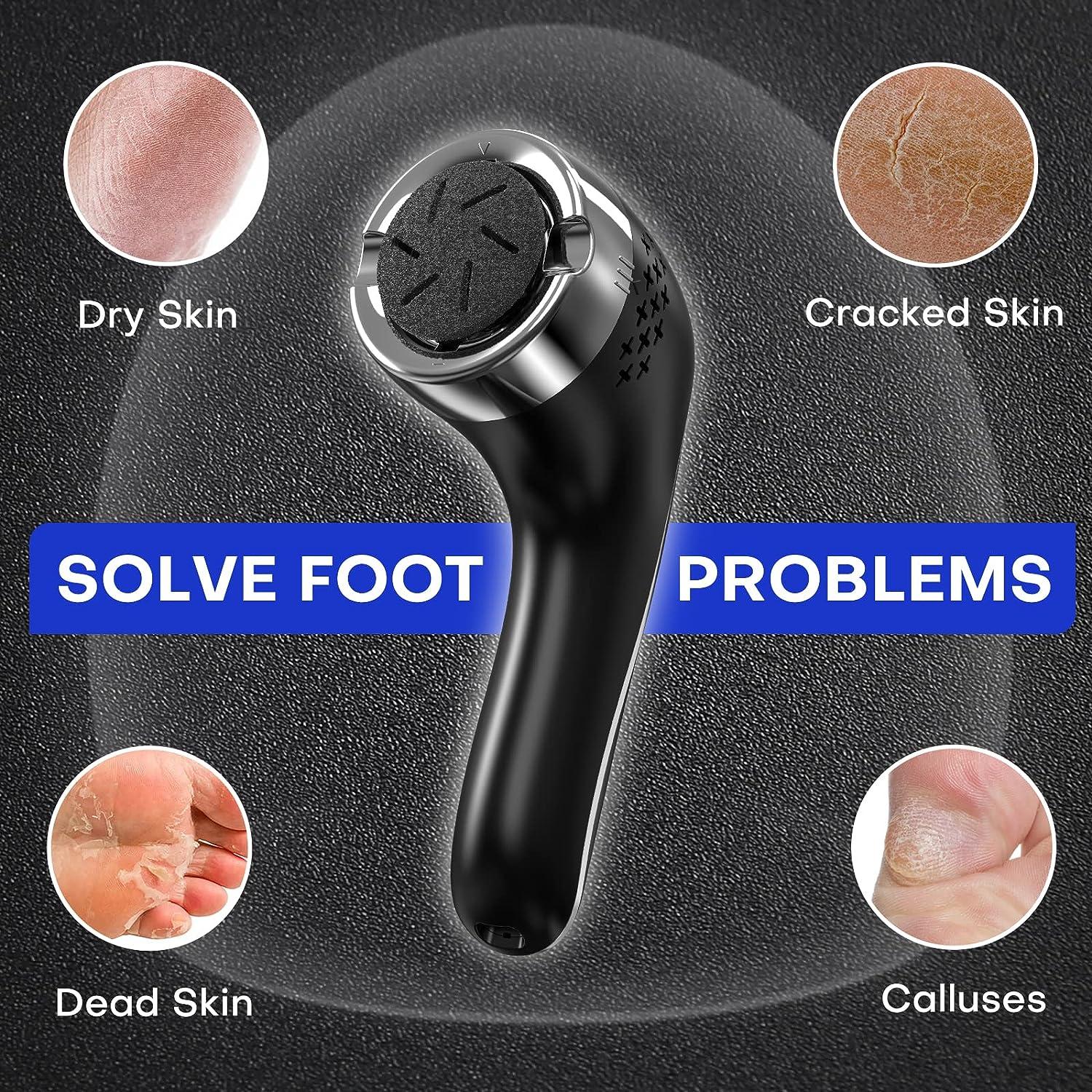 Electric Vacuum Foot Grinder, Pedicure Electric Feet Skin Callus Remover  Tool, Dead Dry Cracked Heels Professional Care, Electronic Adsorption  Callous