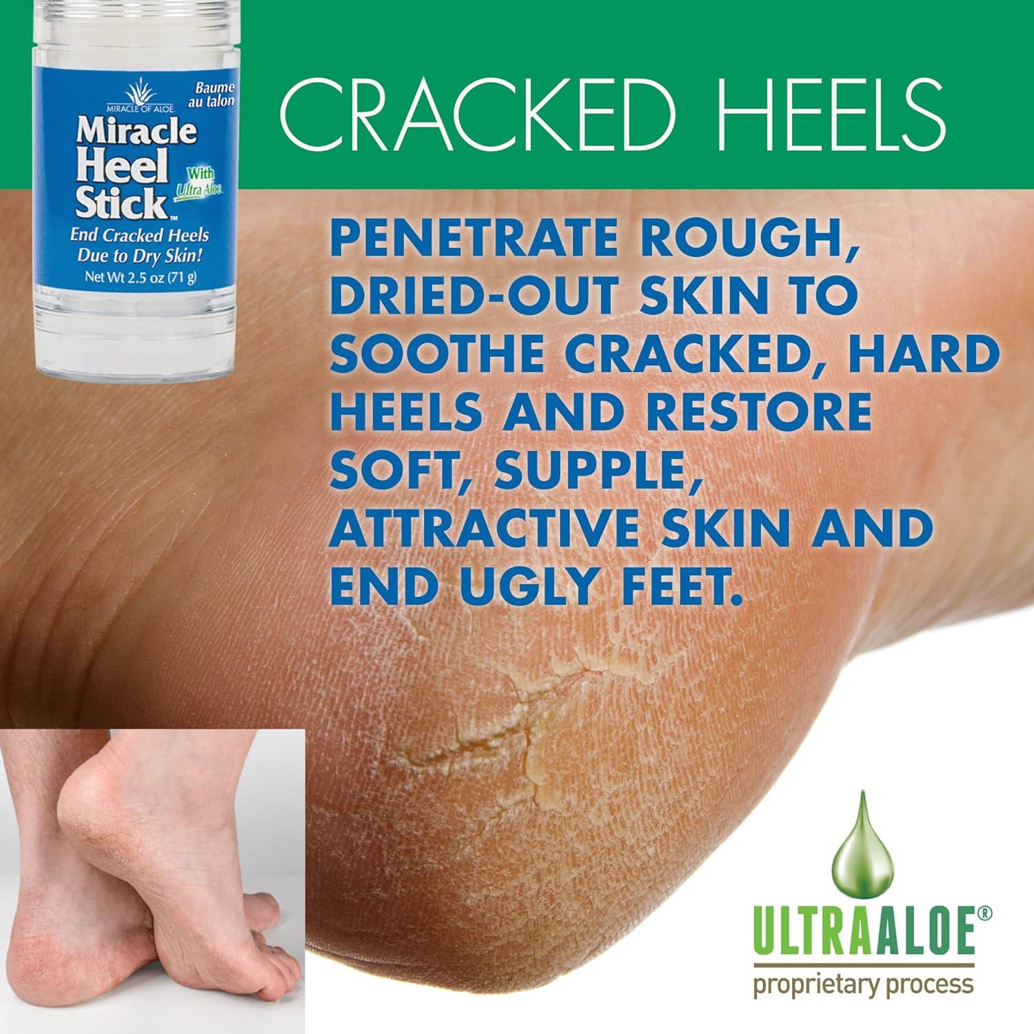 Miracle of Aloe Miracle Foot Repair Cream, 1 oz 3 Pack Repairs Dry India |  Ubuy