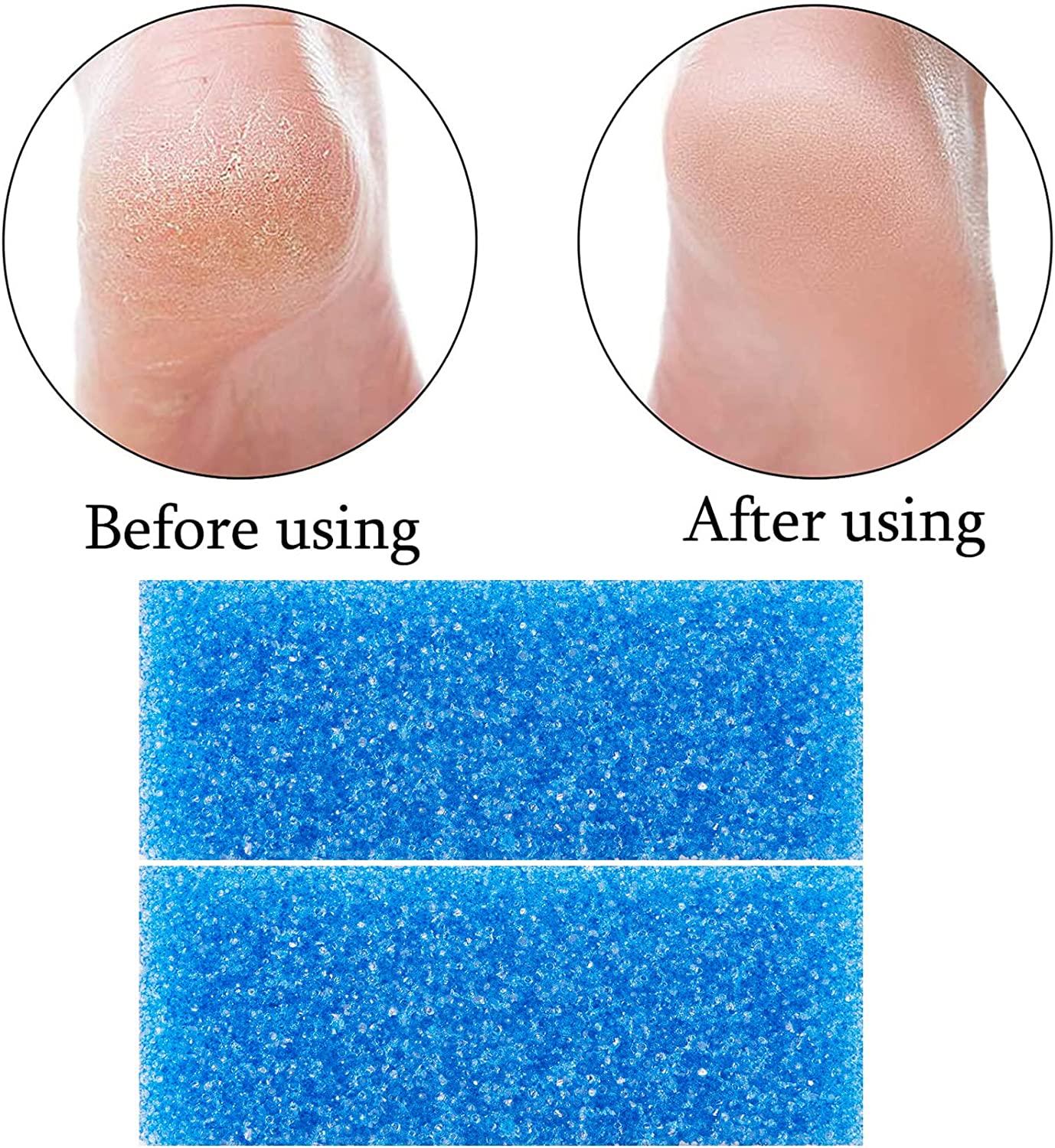 Disposable Foot Scrubber Sponge Pads Pedicure Pumice Stone for Feet Callus  Remover Coarse Blue 40Pcs