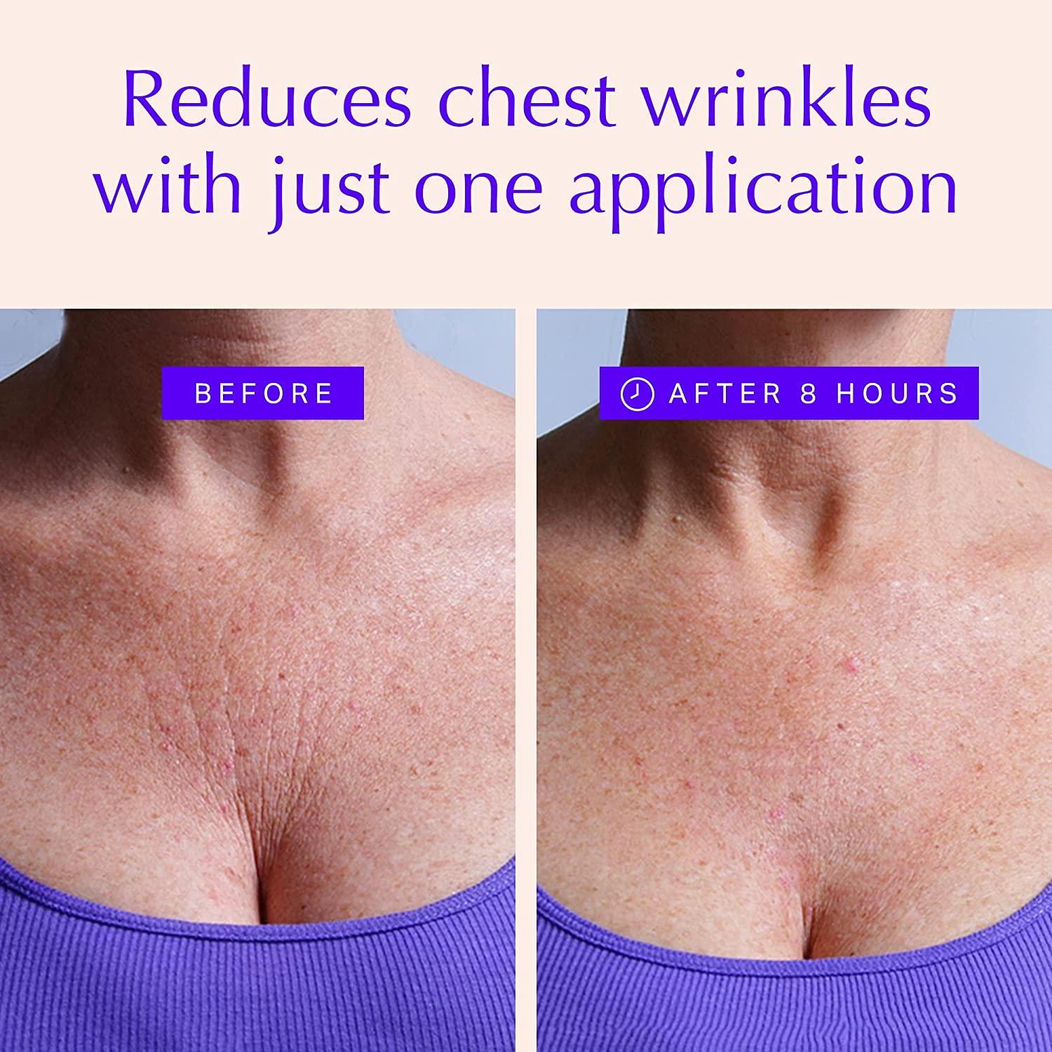 Chest Wrinkle Pads - Anti-Aging Advanced Skin Firming Tightening