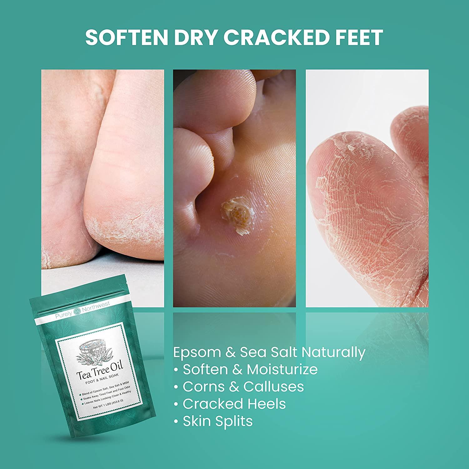 Buy Dr Foot Epsom Salt Peppermint Foot Soak - 200 gm Online At Best Price @  Tata CLiQ