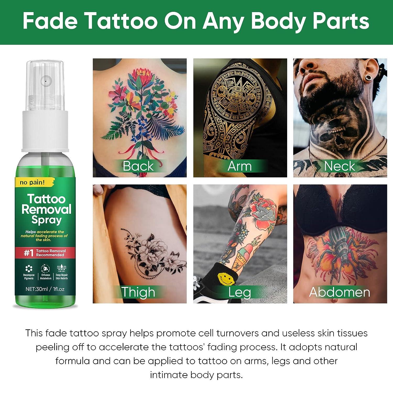 Home - DFW Tattoo Removal