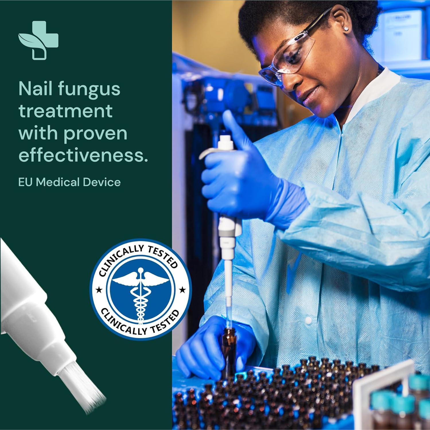 Nail Fungal Infection Medicine, Nail Repair Serum Anti Fungal, Nail Care  Serum Repair Fungal at Rs 2590/box | Nail Cream in Haridwar | ID:  2852449365988