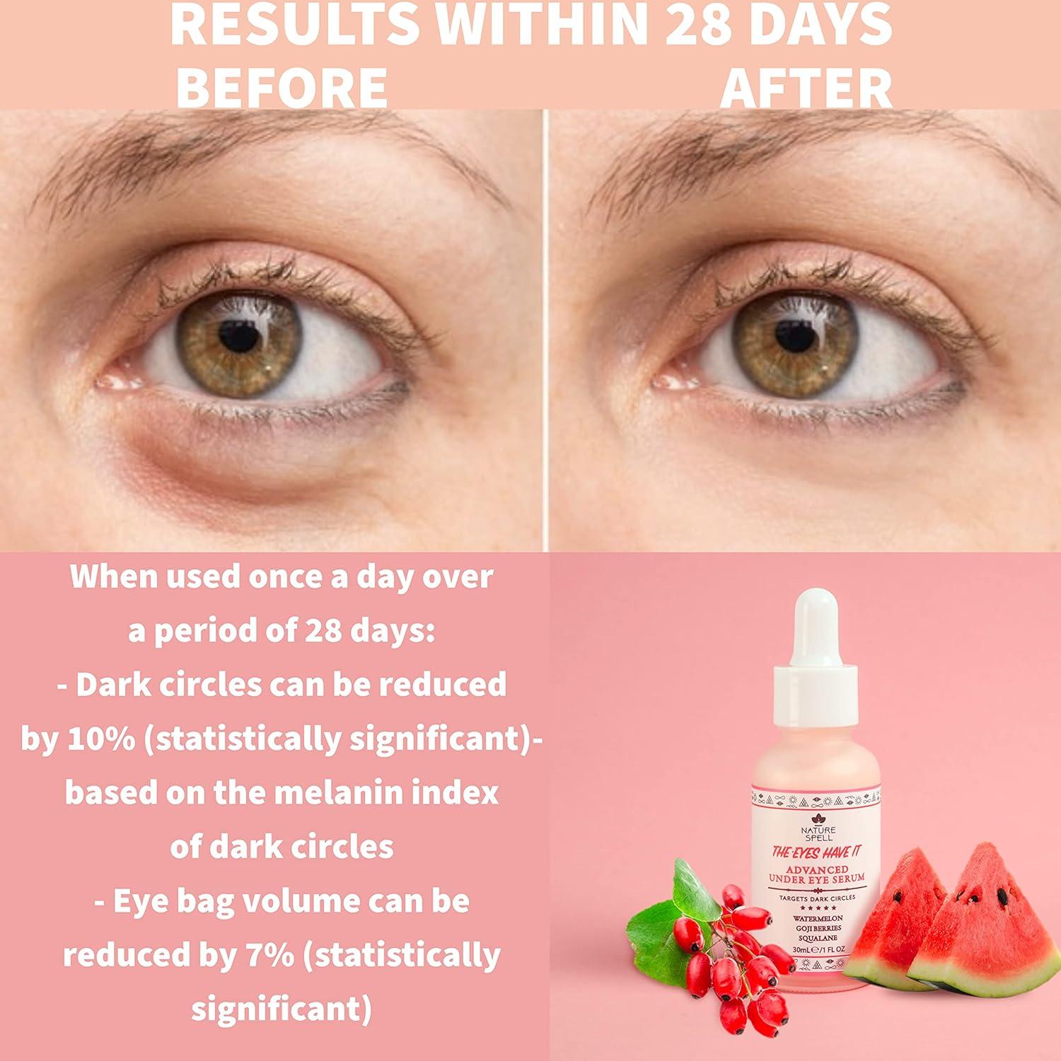 Nature Spell Anti Aging Eye Serum with Watermelon & Goji Berries 30 ml  Targets Dark Circles Puffiness & Eye bags - Anti Wrinkle Eye Cream - 100%  Vegan Made in the UK