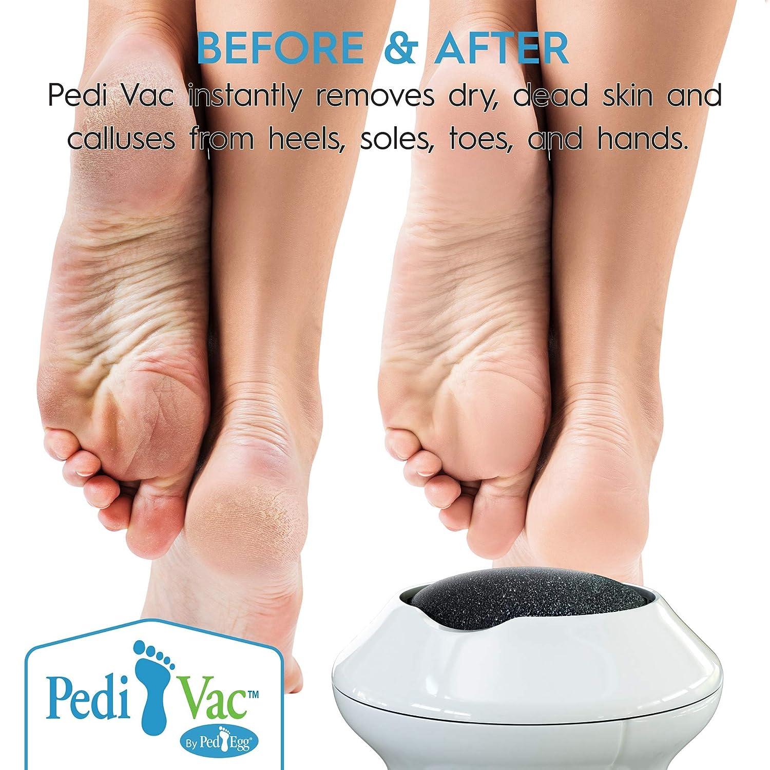 ampk electric feet callus remover with vacuum rechargeable