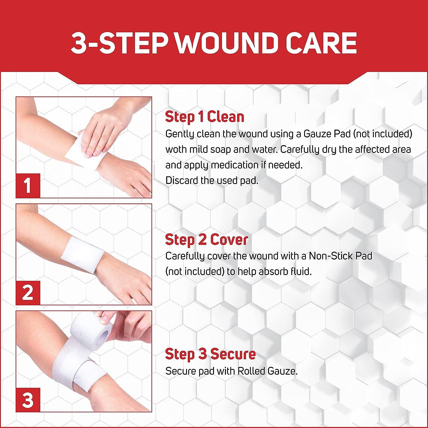 Basic steps to wound healing at home