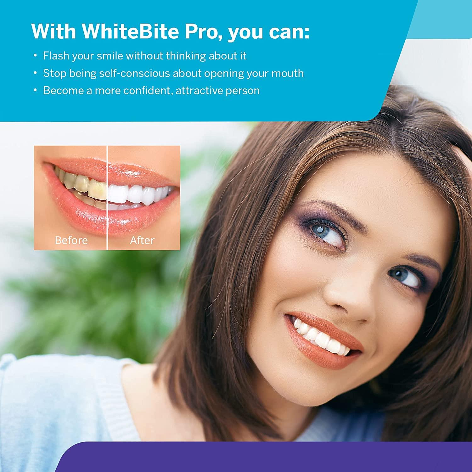 Whitebite Pro Teeth Whitening Kit with LED Light for Sensitive Teeth