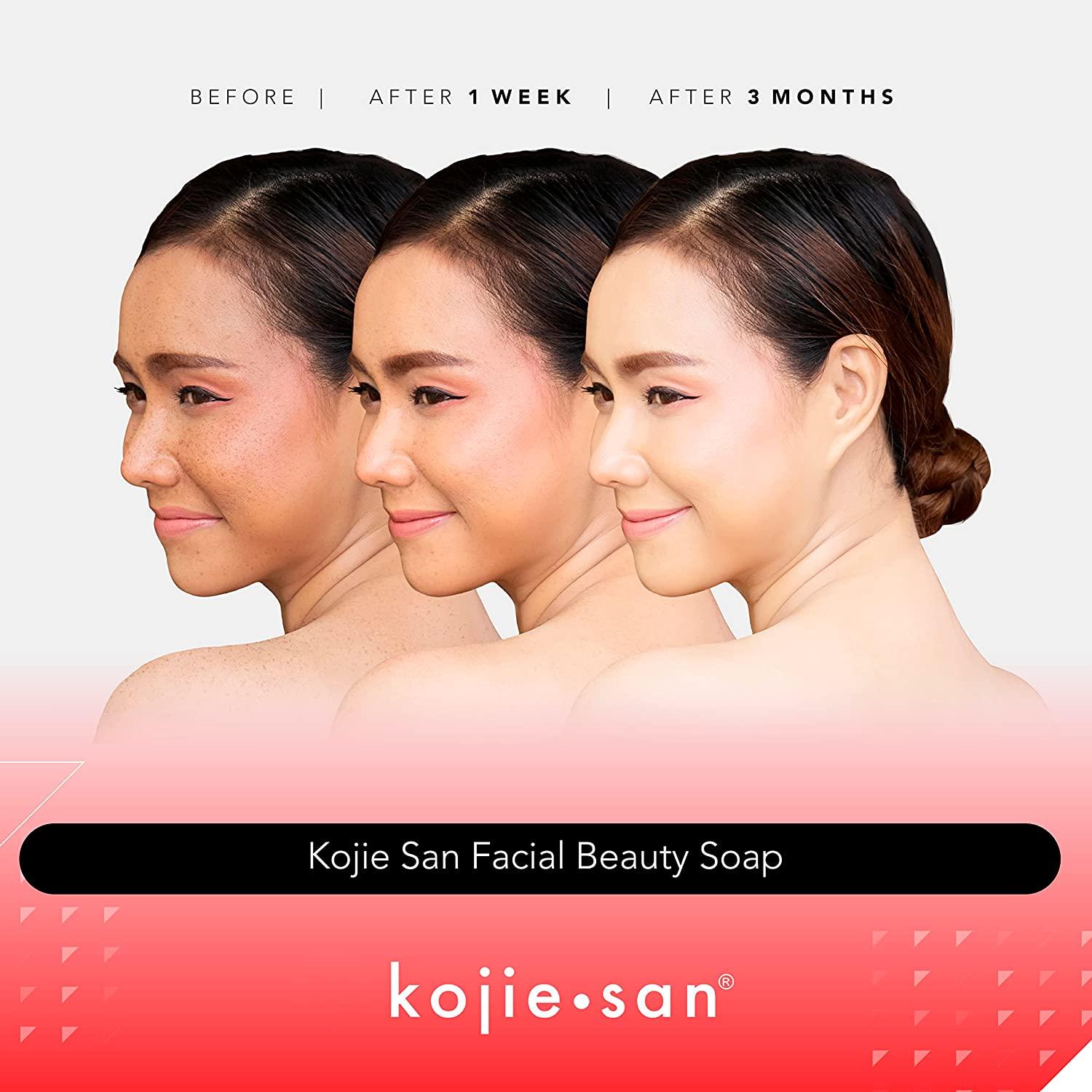Original Kojie San Facial Beauty Soap, 135g, 2 Bars, Guaranteed Original