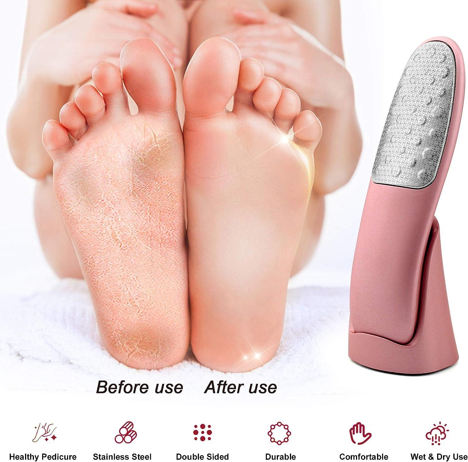 Foot Scrubber with Stand, Never-Cut-Your-Feet Foot File Callus Remover -  Safe to Use | Comfortable Foot Scraper Feet Scrubber Dead Skin Remover,  Best