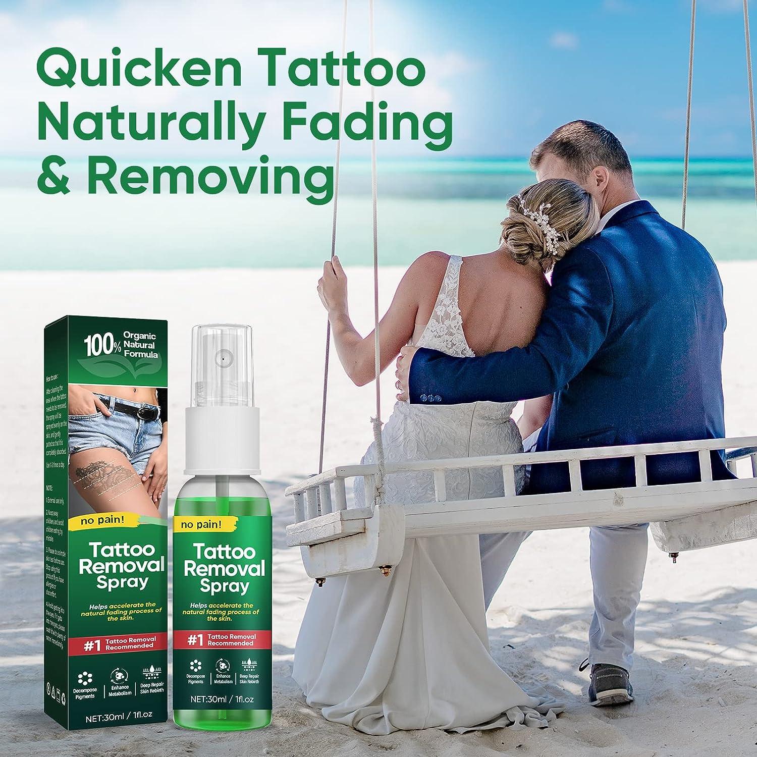 Tattoo Removal Marketing | Tattoo Removal Lead Generation | OppGen