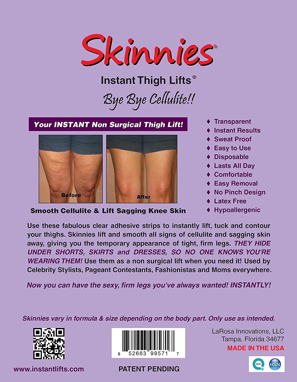 Skinnies Instant Lifts - 5 Pair Thigh Lifts- PATENTED MADE IN THE USA LIFTS  THIGH SKIN INSTANTLY Shark Tank Product Adhesive Strips Instantly Lift Skin  & Smooth Cellulite THE ORIGINAL INVENTOR