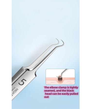 Professional Facial Blackhead Remover Tweezers Extractor Acne Removal Kit Pimple  Popper Tool Clip for Whiteheads Acne Clip Ingrown Hairs Tweezers Blackheads  Remover Extractor Stainless Steel