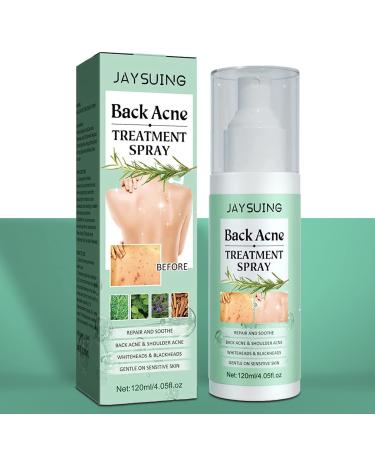 Back Acne Treatment  Back Acne Spray  2% Salicylic Acid Spray  Body Acne Treatment with Herbal Formula  Body Acne Spray  Tea Tree Oil Spray  Acne Treatment For Teens  Back Acne Solution