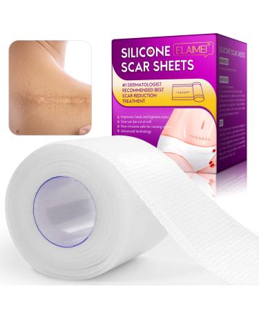 Silicone Scar Sheets (1.6 x 60Inch-3M), Silicone Scar Strips, Silicone Scar  Tape Roll, Medical Grade, Reusable Scar Gel, Professional Scar Removal  Sheets 