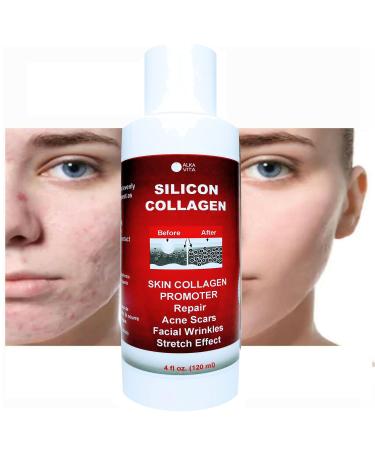 Skin Scars Silicon and Collagen Hydrolyzed Gel Resurfacing Skin Collagen Promoter For Indented Atrophic Rolling Face Scars By ALKA VITA