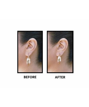 Lobe Wonder Ear Lobe Support Patches - 60 ct. : : Health
