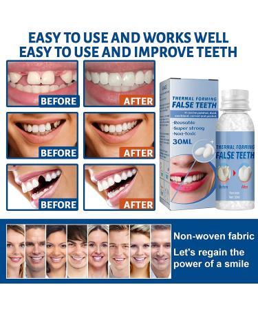 Tooth Repair Kit,DIY Thermal Fitting Beads,Moldable Temporary False  Teeth,Restore Confidence Smile