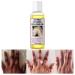 Peeling Oil for Dark Skin, Yellow Peeling Oil with Salicylic Sodium Hyaluronate, Strong Peeling Oil Extra Strength, Exfoliating Peeling Solution for Body All Skin Type - 110ML/3.66 OZ