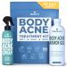 Body Acne Treatment Kit, Pimple-Clearing for Chest, Shoulder, Back, Butt, & Thigh, Salicylic Acid Spray + Aloe Vera Skin Care Repair Gel for Stubborn Zits on Adults & Teens, 90-Day Supply by TreeActiv